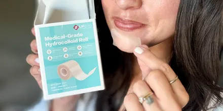 This Hydrocolloid Roll Will Be Your Go-To for Acne (It's